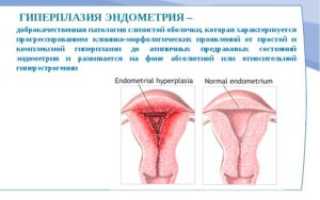 При климаксе разрастание эндометрия