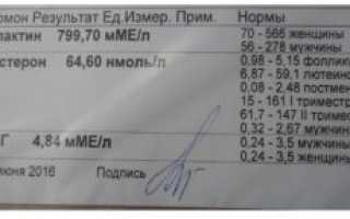 Прогестерон высокий у мужчин