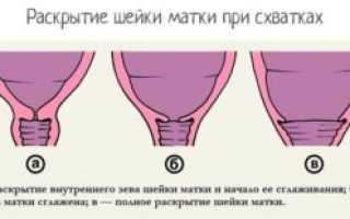 Если внутренний зев закрыт могут ли подтекать воды