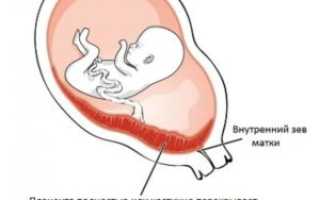 Плацента по передней стенке матки что значит