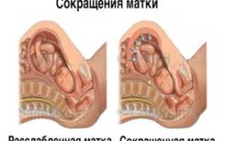 Что делать если матка после родов плохо сокращается