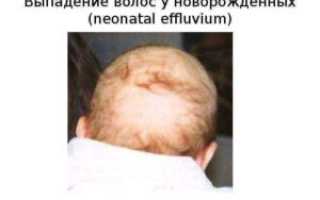 Когда выпадают волосы у новорожденных