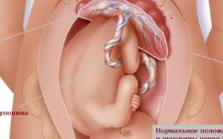 Живот тянет на 40 неделе