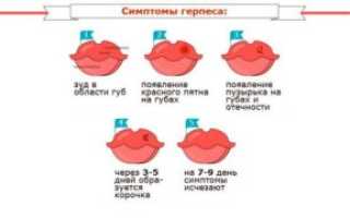 Герпес на носу при беременности на ранних сроках