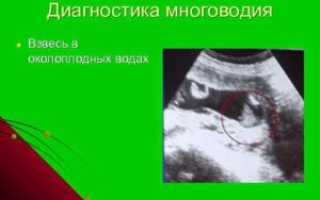 Взвесь в околоплодных водах на 18 неделе беременности