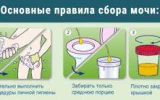 Как правильно сдать общий анализ мочи при беременности