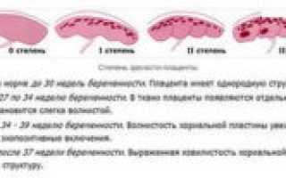 Степень зрелости плаценты 3 на 37 неделе беременности